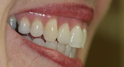 youthful smile after Bend
