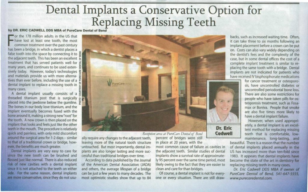 Cascade Business News PureCare Dental Implants