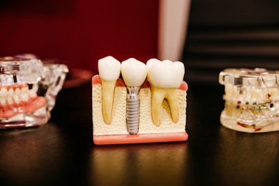 Dental Tooth Implant