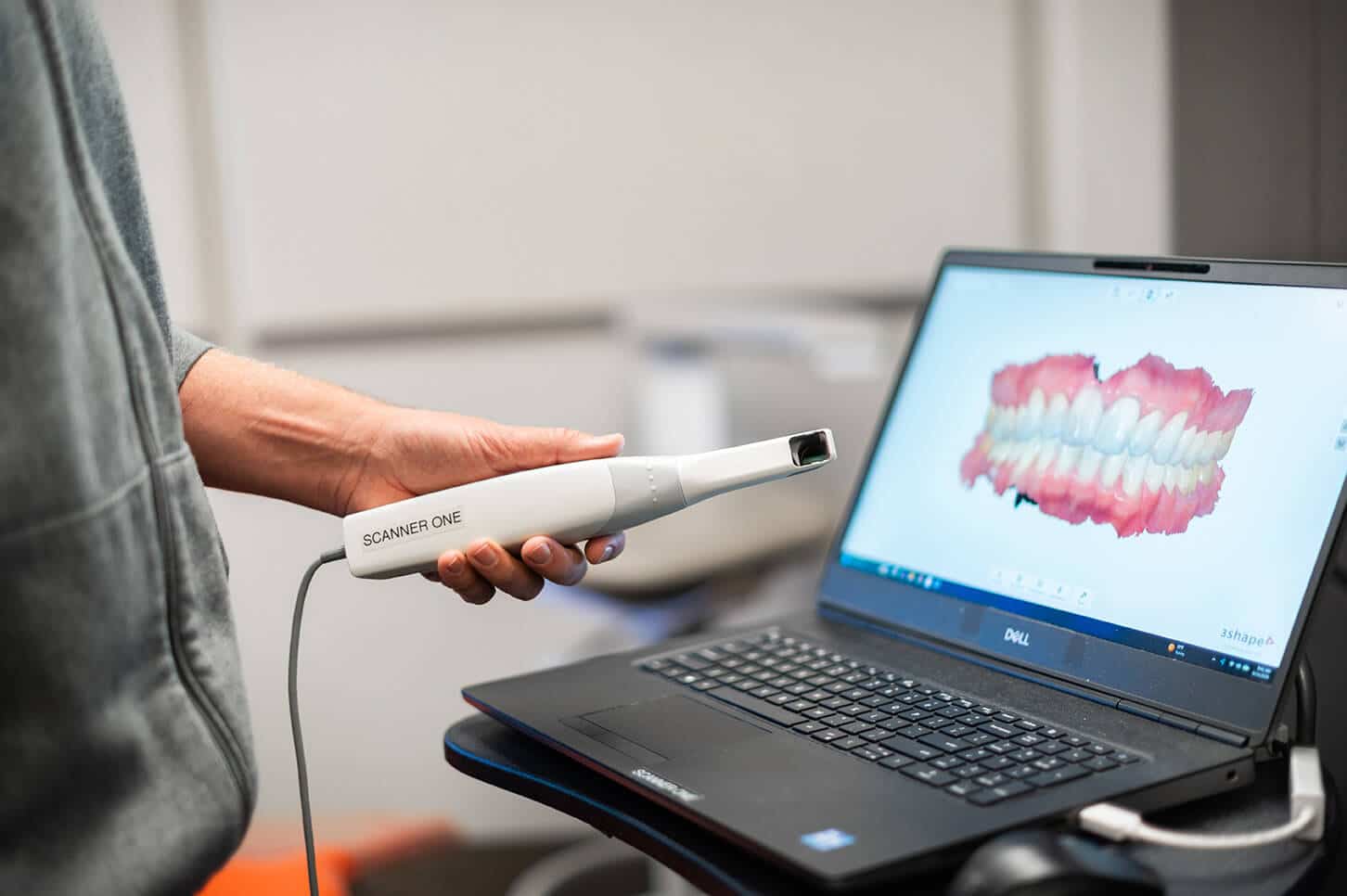 Digital dental scanner and treatment planning technology at PureCare Dental