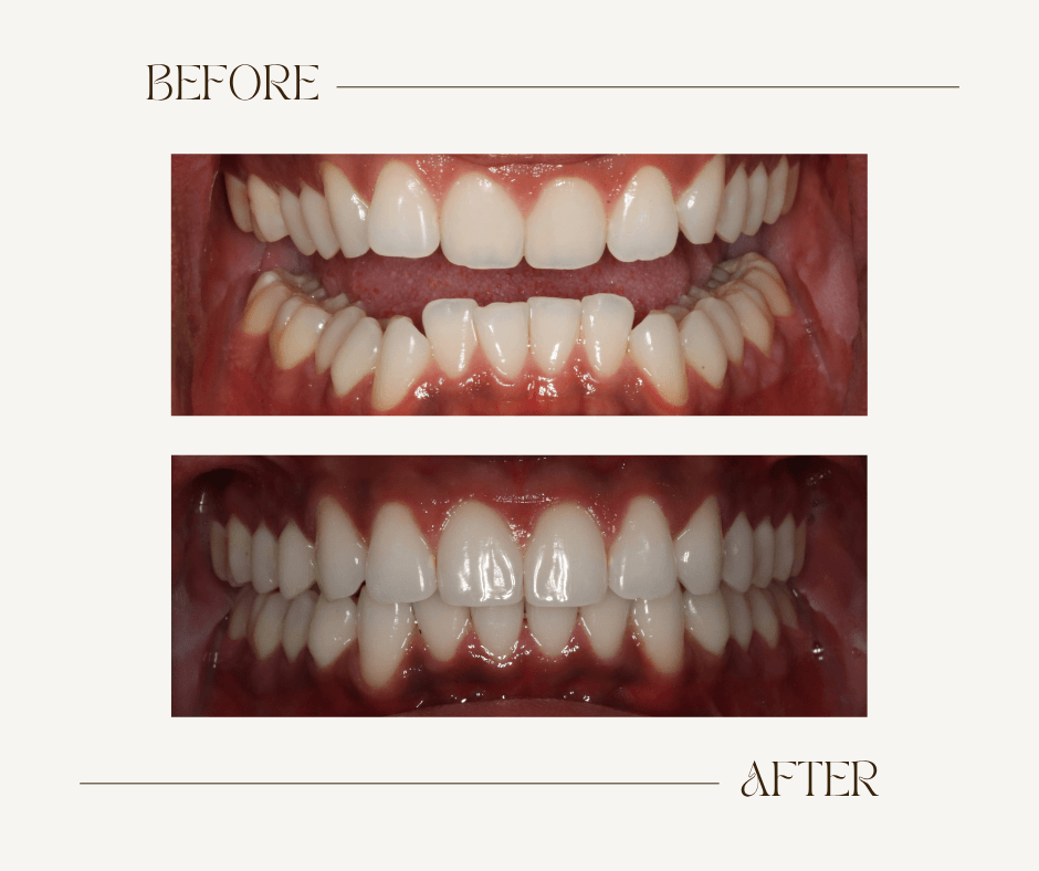 Bryan Before-After Ortho 2