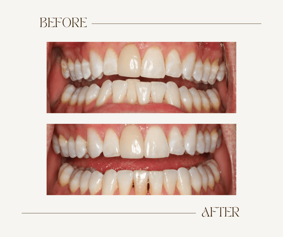 Nate Before-After Ortho